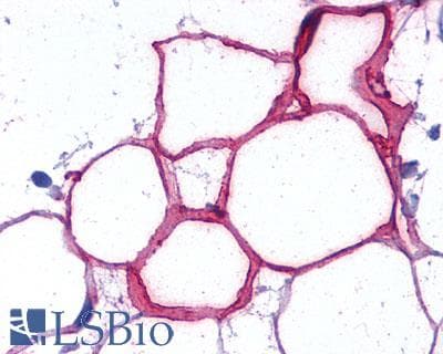 PathPlus™ FPR2 / FPRL1 Antibody (C-Terminus)
