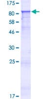Human ZNF549 Protein (Recombinant GST)
