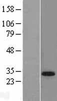 TGIF1 Protein (Over-Expression Lysate Myc-DDK (Flag))