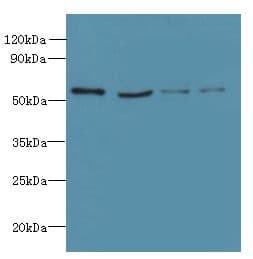 UBE1DC1 / UBA5 Antibody