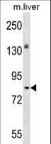 STKLD1 / SgK071 Antibody (aa137-165)