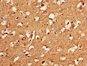 PNMA2 / MA2 Antibody