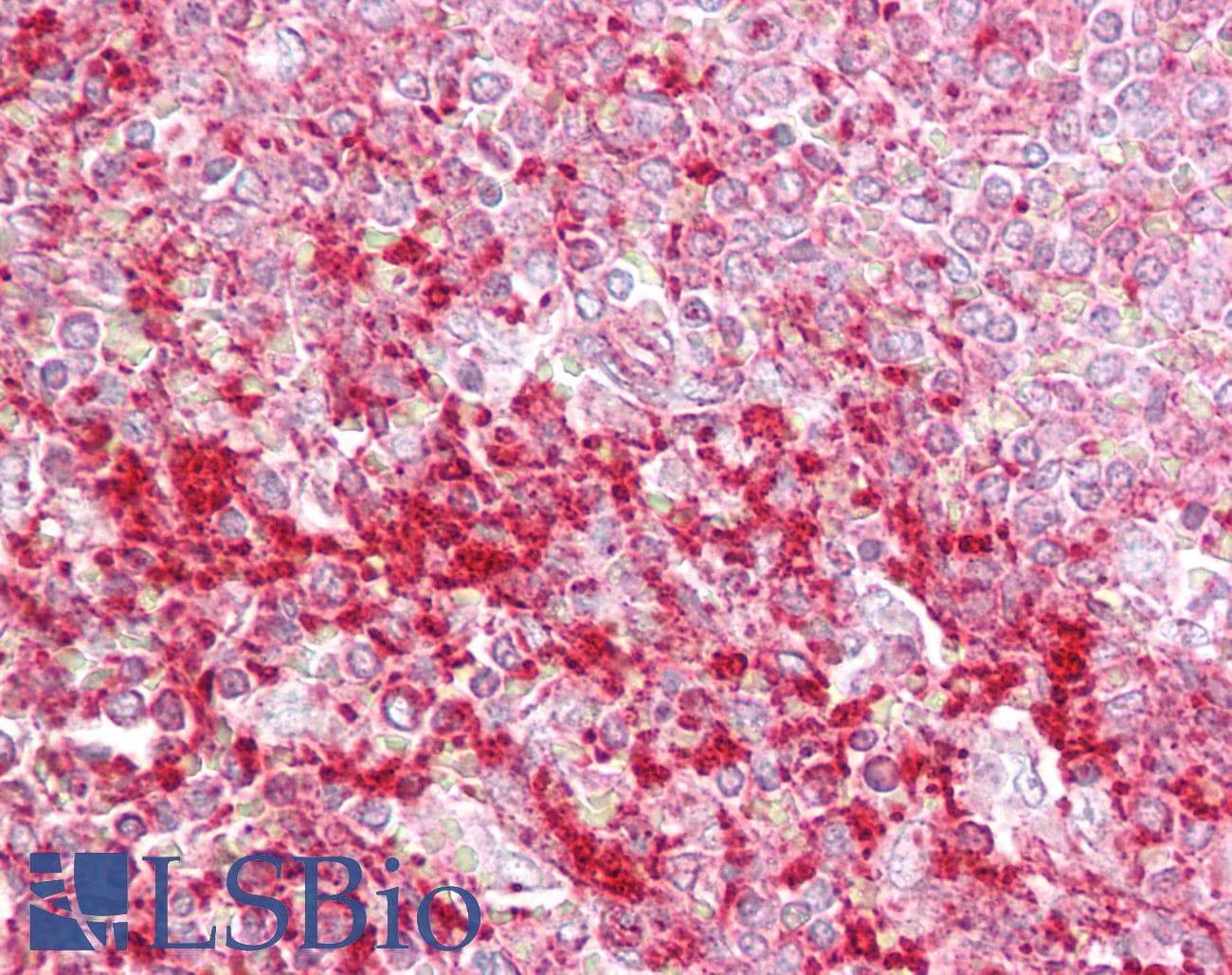 ETV5 / ERM Antibody (N-Terminus)