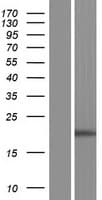 Human DKFZp434A0131 Protein (DKFZP434A0131) (Over-Expression Lysate Myc-DDK (Flag))