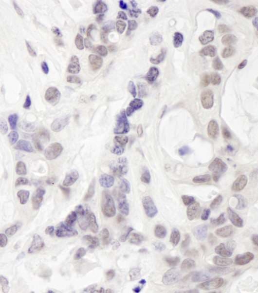 UIMC1 / RAP80 Antibody (aa650-C-term)