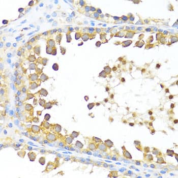 Polyclonal Rabbit anti-Human DAZL Antibody (IHC, IF, WB)