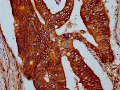 Polyclonal Rabbit anti-Human SIRPA / CD172a Antibody (IHC, IF)