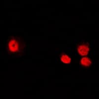 AICAR / ATIC Antibody