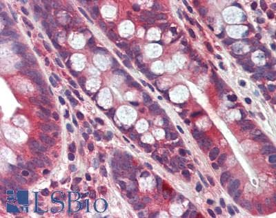 IHC-plus™ PNPLA3 / Adiponutrin Antibody