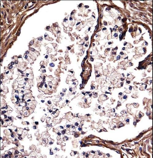 DSG2 / Desmoglein 2 Antibody (aa829-857)