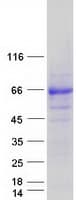 Human ACD / PTOP Protein (Recombinant Myc-DDK (Flag))