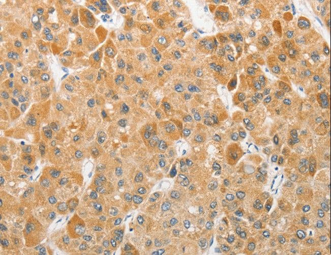 Polyclonal Rabbit anti-Human APG5 / ATG5 Antibody (IHC, WB)