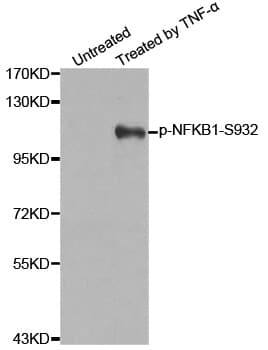 NFKB1 / NF-Kappa-B Antibody (phospho-Ser932)