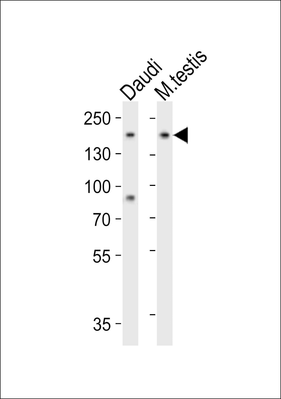 Polyclonal Rabbit anti-Human CD135 / FLT3 Antibody (aa474-510, WB)