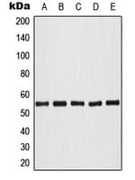 AKT1 + AKT2 + AKT3 Antibody (phospho-Thr308)