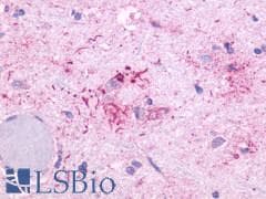 PathPlus™ Polyclonal Rabbit anti-Human OR51E1 Antibody (Cytoplasmic Domain, IHC)