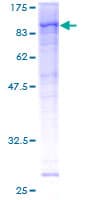 Human RPS6KA1 / RSK1 Protein (Recombinant GST)