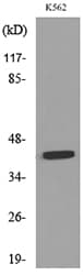 P2RX3 / P2X3 Antibody