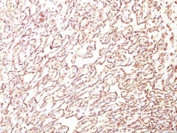 Monoclonal Mouse anti-Human PODXL / Podocalyxin Antibody (clone 4F10, Extracellular Domain, IHC, IF)