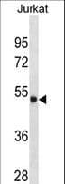 ARSA / Arylsulfatase A Antibody (aa408-439)