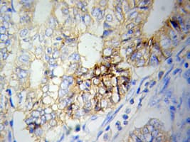 Polyclonal Rabbit anti-Human NAMPT / Visfatin Antibody (IHC, IF, WB)