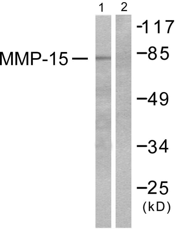 Polyclonal Rabbit anti-Human MMP15 Antibody (WB)