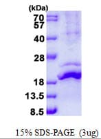 Human RLN2 / Relaxin 2 Protein (Recombinant His)