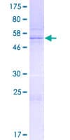 Human SYCP3 / SCP3 Protein (Recombinant GST)
