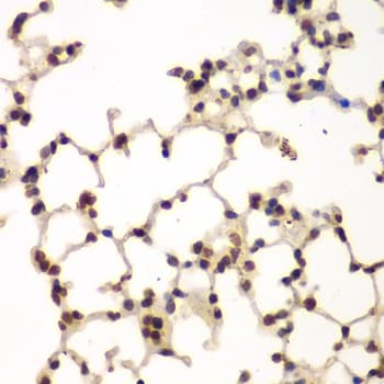 PRKCB / PKC-Beta Antibody