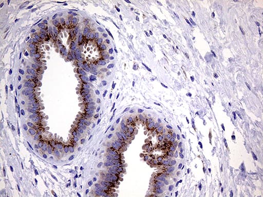 MYOT / Myotilin Antibody (clone OTI5E11, Carrier-free)