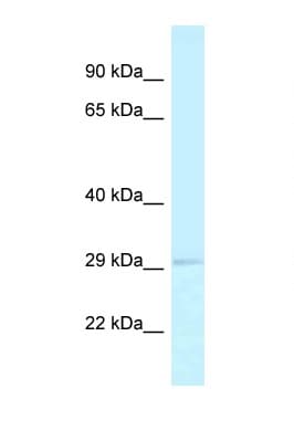 Polyclonal Rabbit anti-Human RPA2 / RFA2 / RPA34 Antibody (aa28-77, WB)
