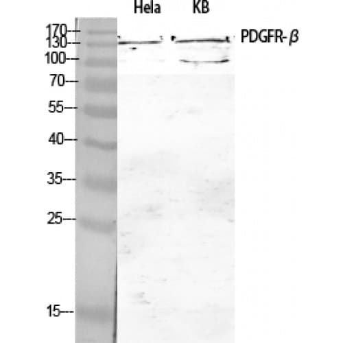 Polyclonal Rabbit anti-Human PDGFRB / PDGFR Beta Antibody (690-770 aa, IHC, IF, WB)