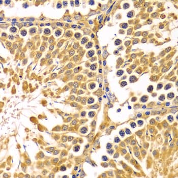 PIBF1 / PIBF Antibody