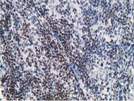 DCK / Deoxycytidine kinase Antibody (clone OTI3F5)