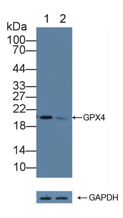 GPX4 / MCSP Antibody (aa74-197)
