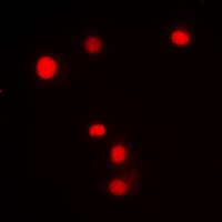 Polyclonal Rabbit anti-Human SP1 Antibody (phospho-Thr453, IHC, IF, WB)