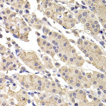 DFFA / ICAD / DFF45 Antibody