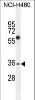 VSTM4 Antibody (aa142-170)