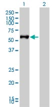 FGL2 Antibody (clone 6D9)