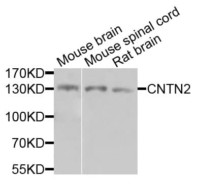 CNTN2 / TAX Antibody