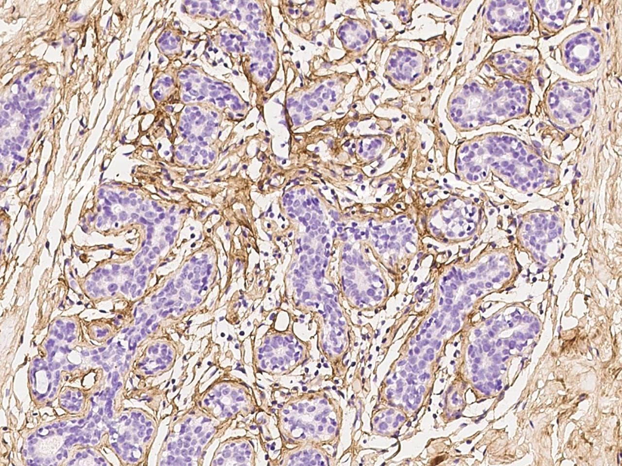 POSTN / Periostin Antibody
