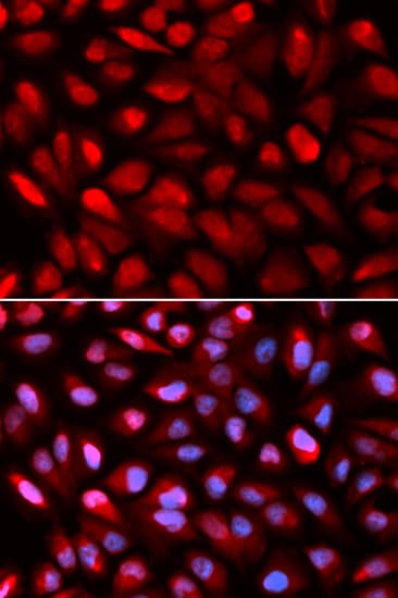 IHC-plus™ Polyclonal Rabbit anti-Human HNRNP-E2 / PCBP2 Antibody (IHC, IF, WB)