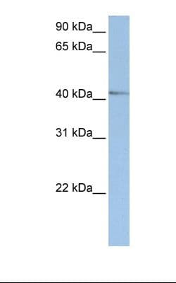 NR2E1 / TLX Antibody (aa144-193)