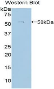 LAMB3 / Laminin Beta 3 Antibody (aa352-587)