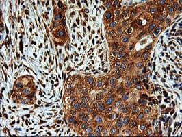 ERGIC-53 / LMAN1 Antibody (clone OTI1C5)