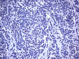 Monoclonal Mouse anti-Human MDM2 Antibody (clone OTI1E6, IHC, WB)