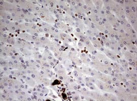 KRT7 / CK7 / Cytokeratin 7 Antibody (clone OTI1C5)