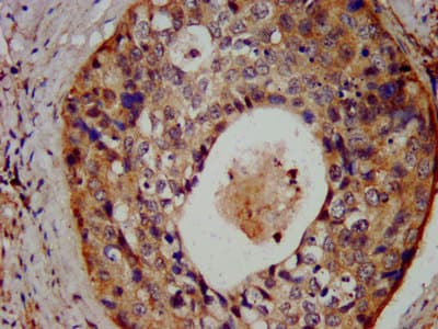 Polyclonal Rabbit anti-Human FAP-1 / PTPN13 Antibody (IHC, IF)