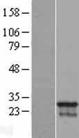 Human CDCA4 Protein (Over-Expression Lysate Myc-DDK (Flag))