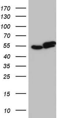 RAD23B / HR23B Antibody (aa1-253, clone OTI9F8)